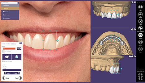Blog Tecnología 3D Odontología